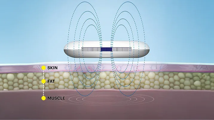 Drawing showcasing active magnetic pulse technology in action